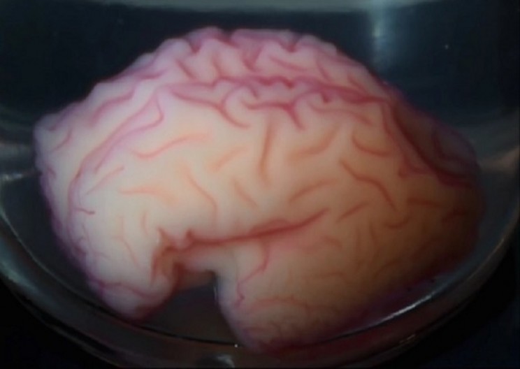 Scientists Replicate Folding of Fetal Brain