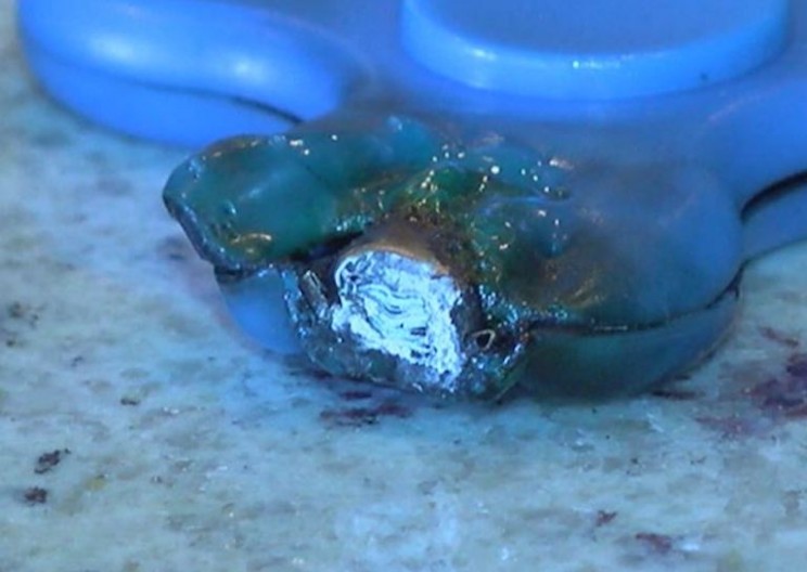 Fidget Spinners Are Now Bursting Into Flames and Terrifying Children