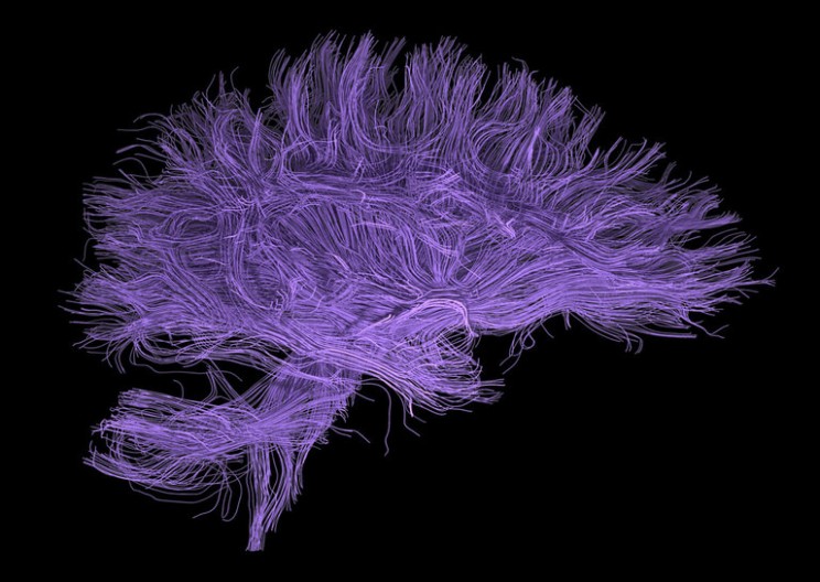 These Mini-Brains Could Lead to Huge Possibilities
