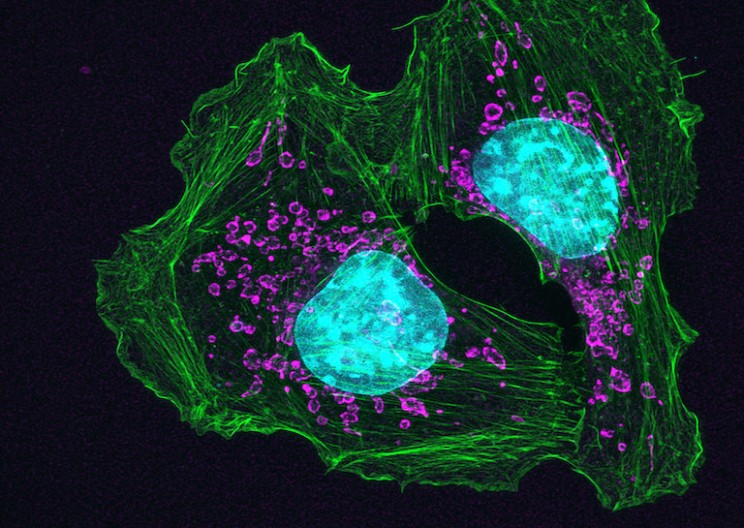 'Universal' Cancer Vaccine is Undergoing First Trials