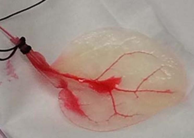 Researchers Grow Human Heart Tissue on Spinach Leaves