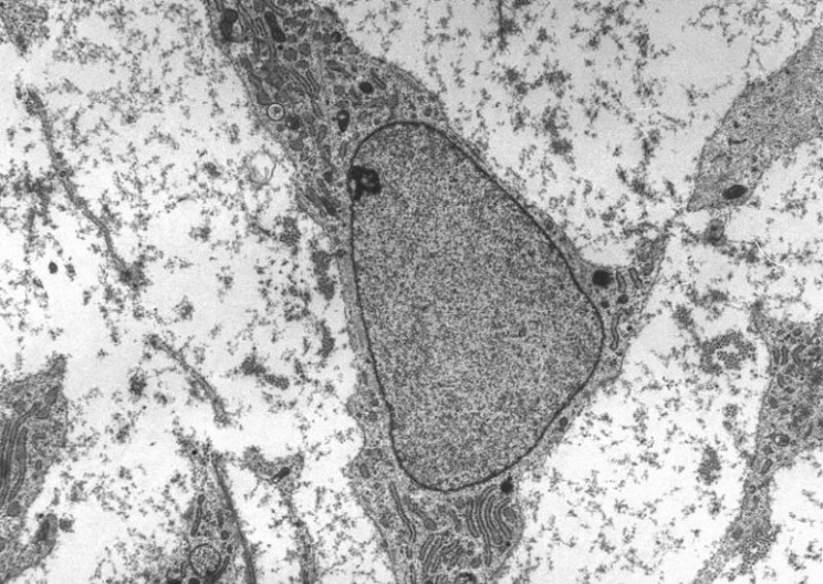 Super Material Graphene Could Be Key in Regenerating Nerve Cells