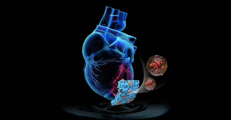 Off-the-Shelf Artificial Patch Improves Cardiac Function by 50%