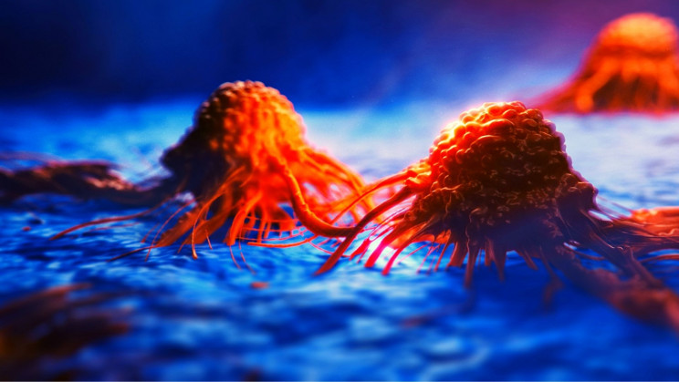 Doctors Say All Cancers Can 'Switch Off' to Evade Treatment