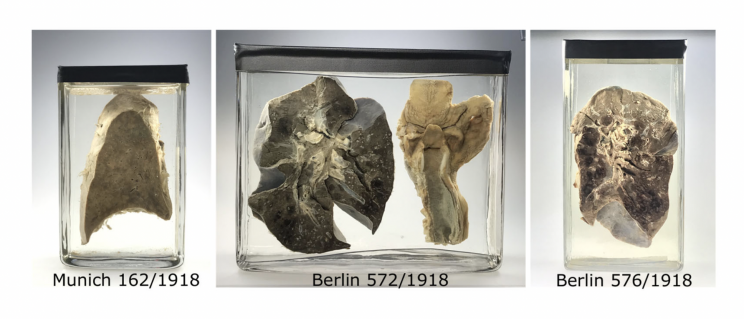 Will Covid exist in 2120? These lungs from 1918 could hold the secret Will Covid exist in 2120? These lungs from 1918 could hold the secret