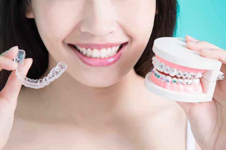 Door to the New Orthodontics: Who Invented the Invisible Invisalign? Door to the New Orthodontics: Who Invented the Invisible Invisalign?