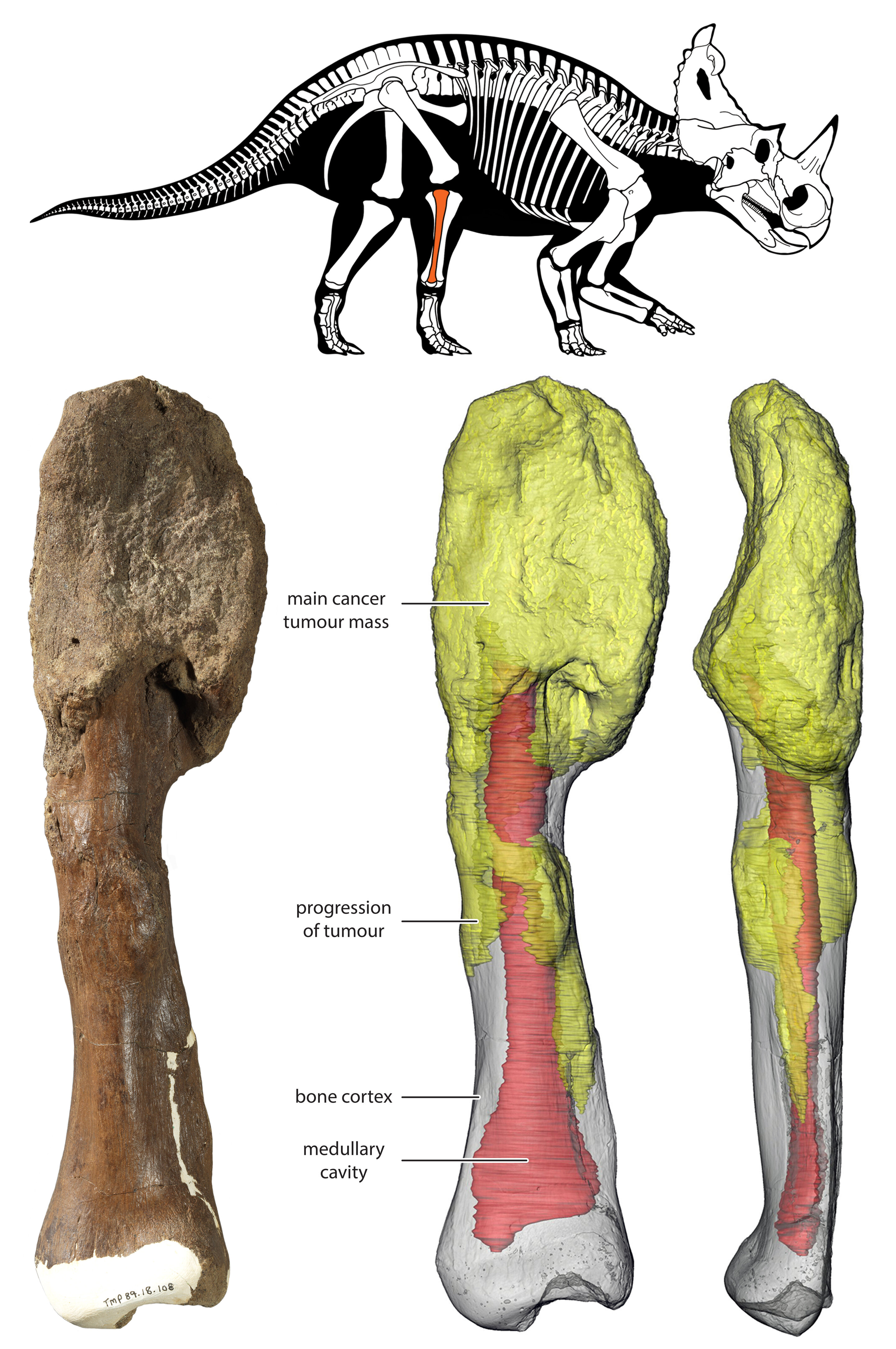 Scientists Have Diagnosed a Dinosaur With Malignant Cancer In Historic First Scientists Have Diagnosed a Dinosaur With Malignant Cancer In Historic First
