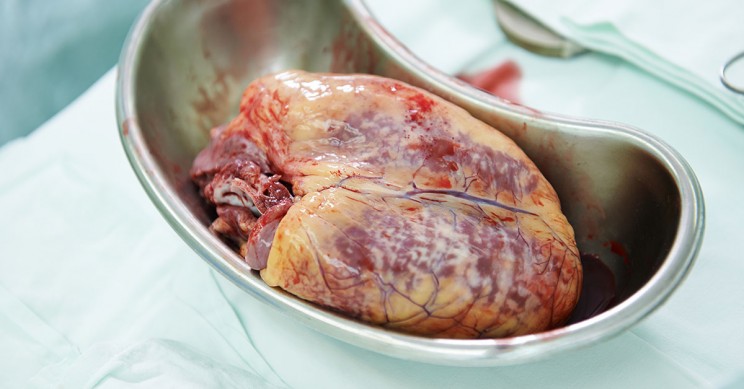 Detainee Organ Harvesting in China Approaches Genocide, China Tribunal Finds