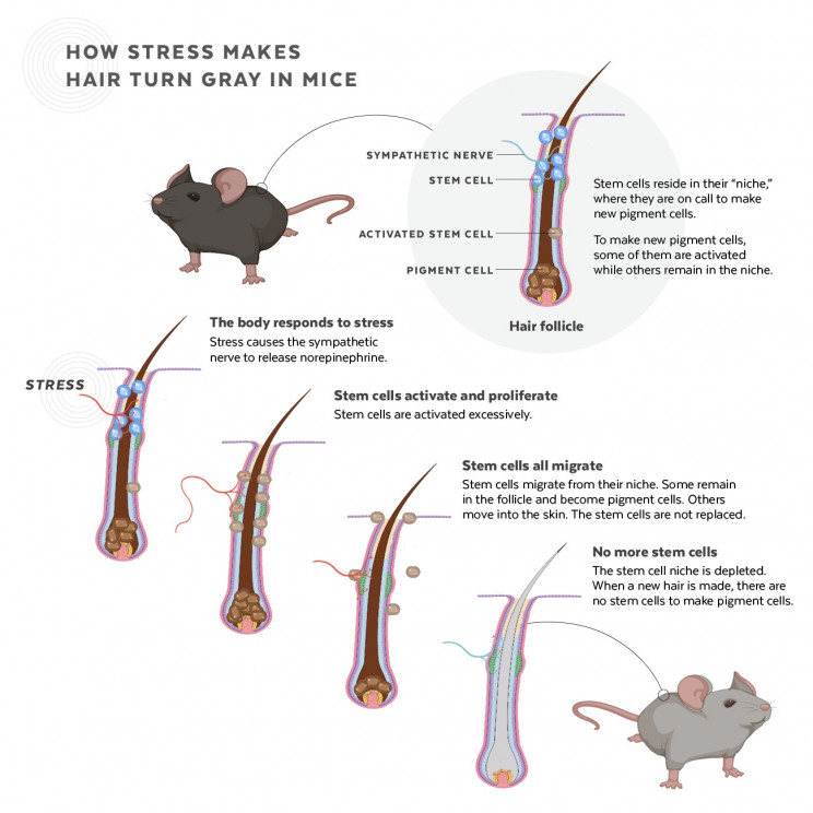 Turns out Stress Really Does Turn Hair Gray, Scientists Confirm Turns out Stress Really Does Turn Hair Gray, Scientists Confirm