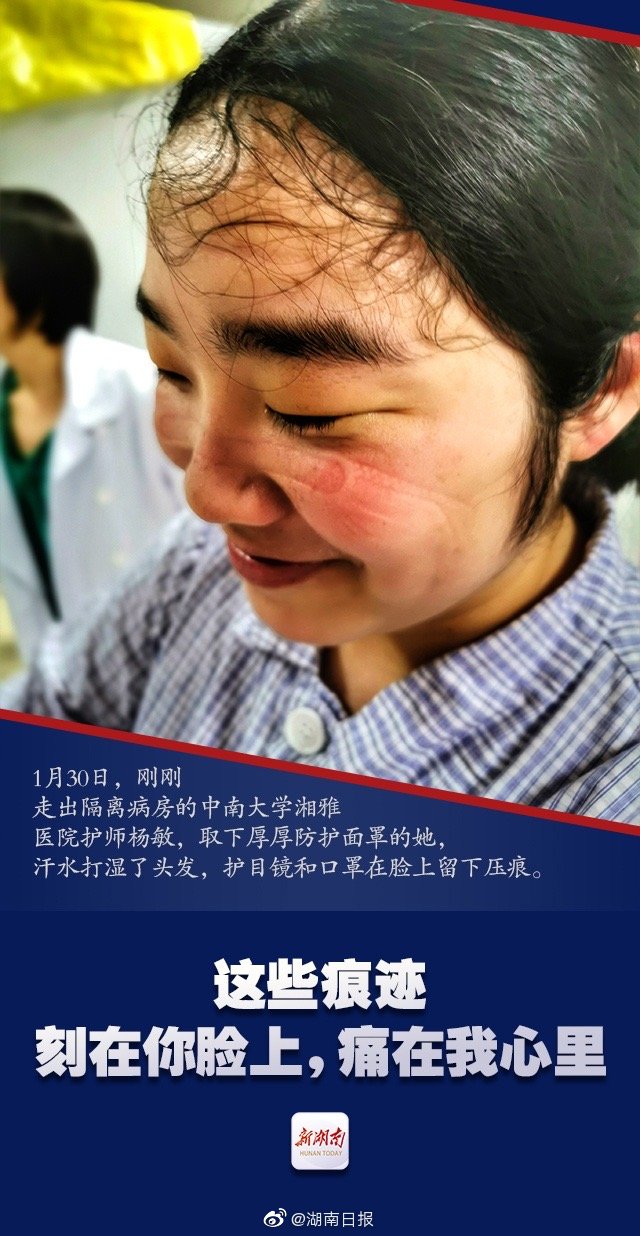 Smiling Faces of Medical Staff in Wuhan After Treating Coronavirus Patients for Hours Smiling Faces of Medical Staff in Wuhan After Treating Coronavirus Patients for Hours