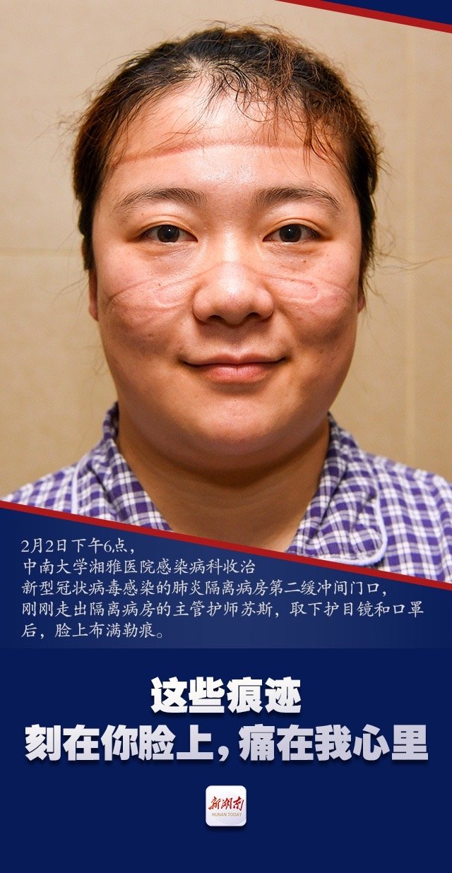 Smiling Faces of Medical Staff in Wuhan After Treating Coronavirus Patients for Hours Smiling Faces of Medical Staff in Wuhan After Treating Coronavirus Patients for Hours