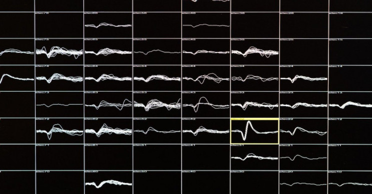 New Implant for the Blind Links Directly into the Brain