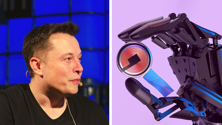 Elon Musk Brain Chip: Elon Musk's Neuralink Took One Step Closer to Implanting Chips Into Human Brains - Vimarsana News