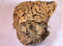 2,600-Year-Old Preserved Brain From UK May Have Finally Revealed Its Secret