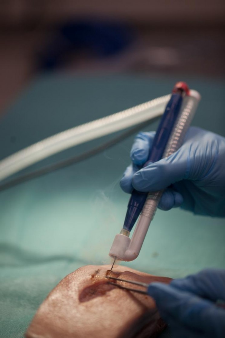 A Novel Way of Discovering Cancerous Tissue in Brain Tumors