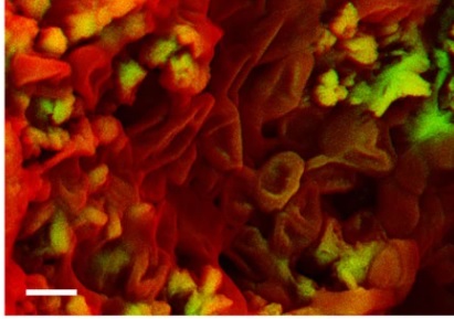 ancient blood cells