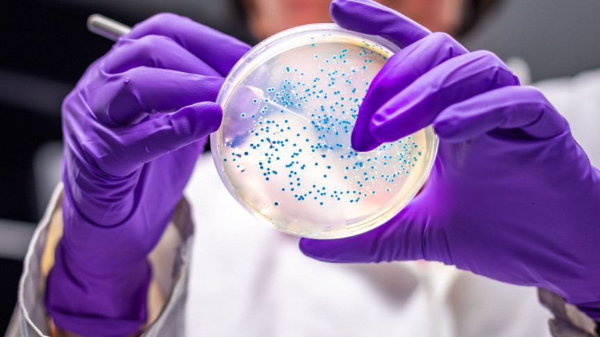 Scientists modified a bacteria to produce a Parkinson's drug - Vimarsana News