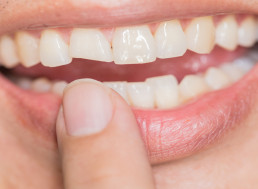 Stem Cells Could Provide New Method of Tooth Repair