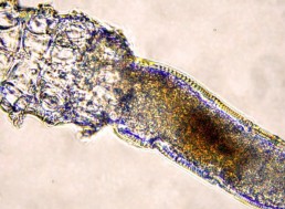 These 'Face Mites' Live in Your Pores and Mate on Your Face