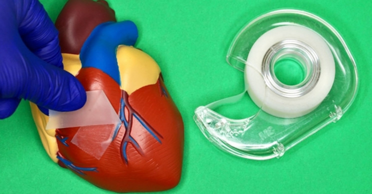 Super-Strong Surgical Tape Can Be Used on Internal Organs and Is Removed in 5 Minutes