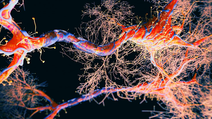Here’s What Experts Really Think About the New Alzheimer’s Drug
