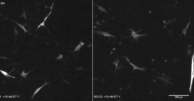 Skin Cells Emit Neuron-Like Bursts Much like Brain Cells, Research Finds