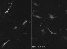 Skin Cells Emit Neuron-Like Bursts Much like Brain Cells, Research Finds