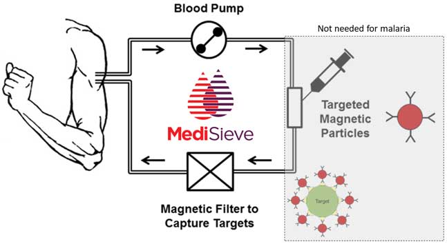 MediSieve MediSieve system diagram