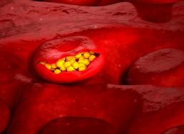 Magnetic Tool That Removes Diseases From the Blood Set For Human Trials