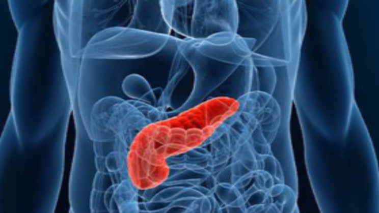 Machine Learning Helps to Drastically Improve Pancreatic Cyst Triage