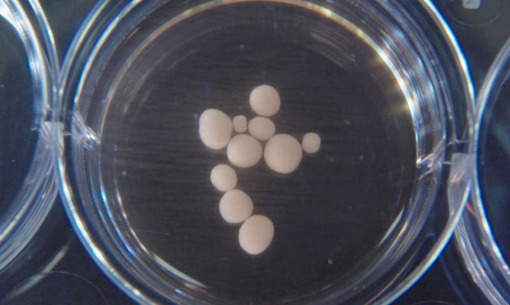 organoids