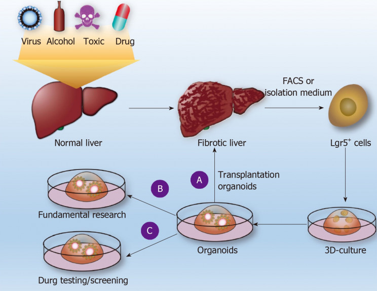 liver fibrosis