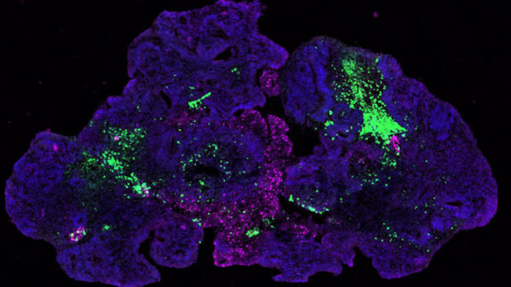 brain organoid