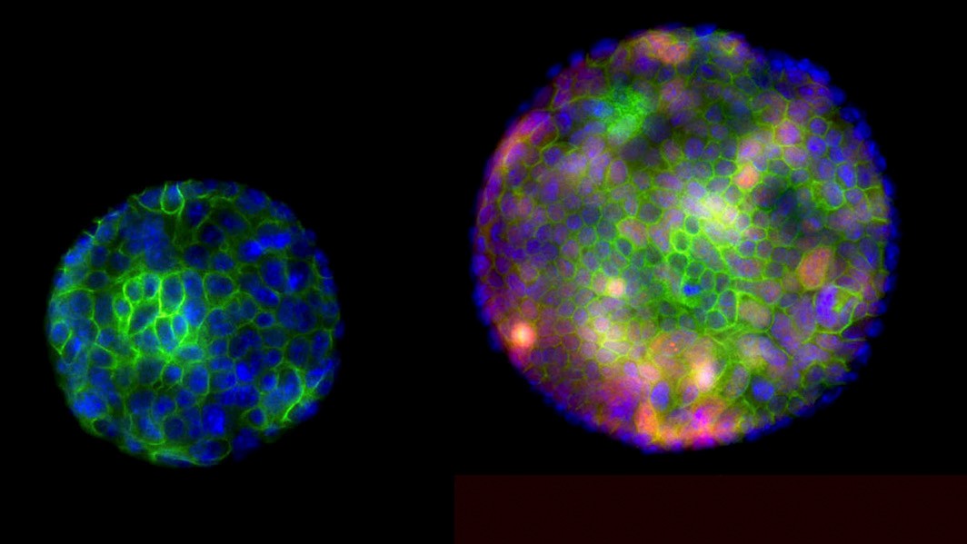 gastric tissue
