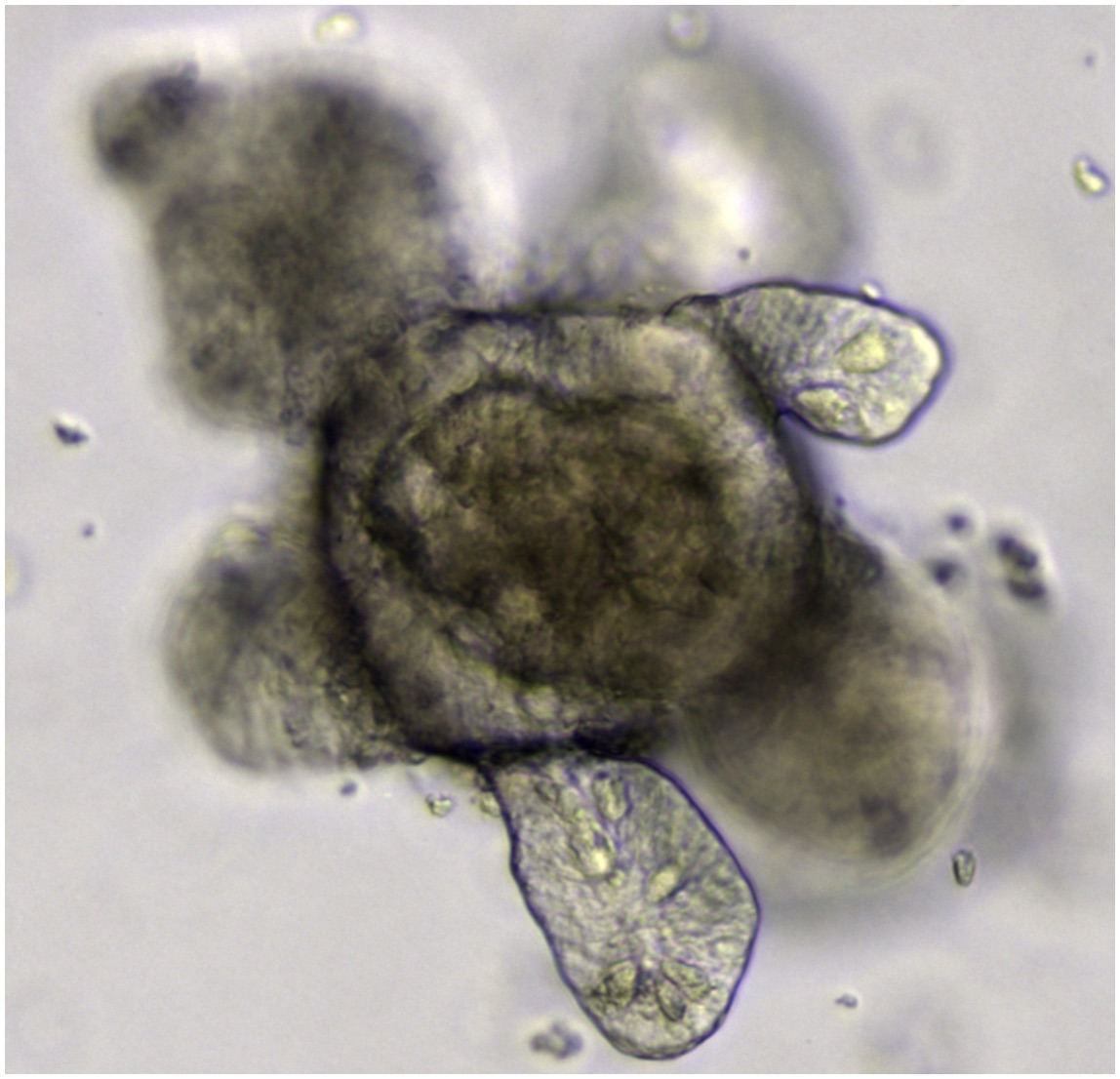 intestine organoid