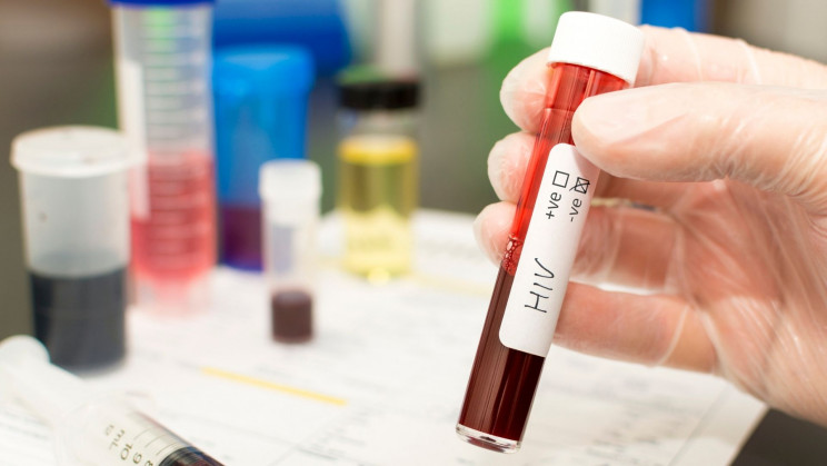 An HIV-Positive Patient Has Cleared Her Body From the Virus Without Treatment