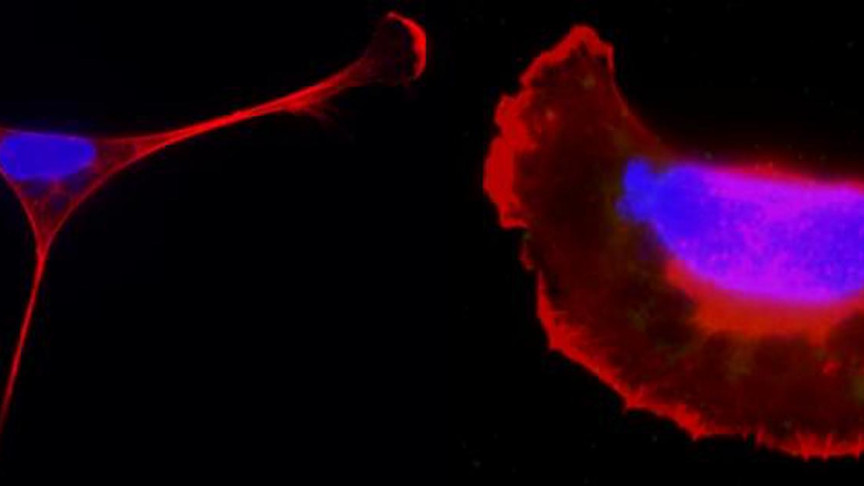 Tödlicher Parasit nutzt seine Wirtszelle, um sich auf den Körper
