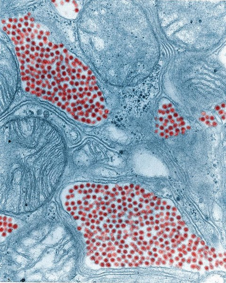 Florida Health Officials Detect the Spread of a Deadly Mosquito Virus Florida Health Officials Detect the Spread of a Deadly Mosquito Virus