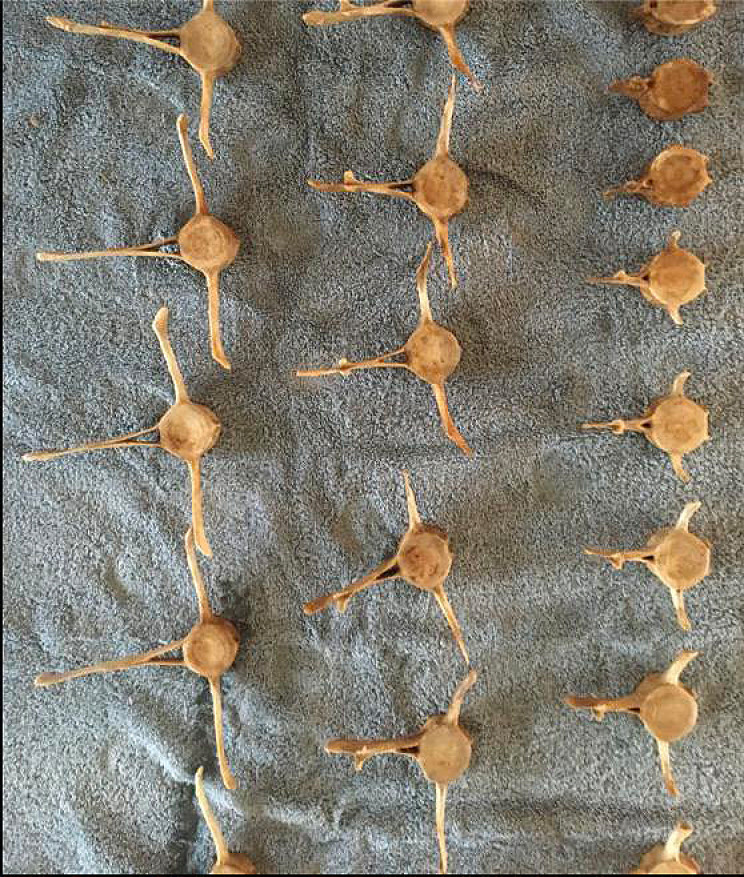 Man Finds Vertebrae Bones on the Beach, Puts Them Back Together Like a Puzzle Man Finds Vertebrae Bones on the Beach, Puts Them Back Together Like a Puzzle