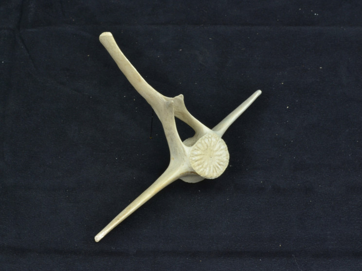 Man Finds Vertebrae Bones on the Beach, Puts Them Back Together Like a Puzzle Man Finds Vertebrae Bones on the Beach, Puts Them Back Together Like a Puzzle