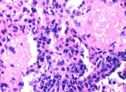 CRISPR Edited Viruses Are the New Enemy of Superbugs