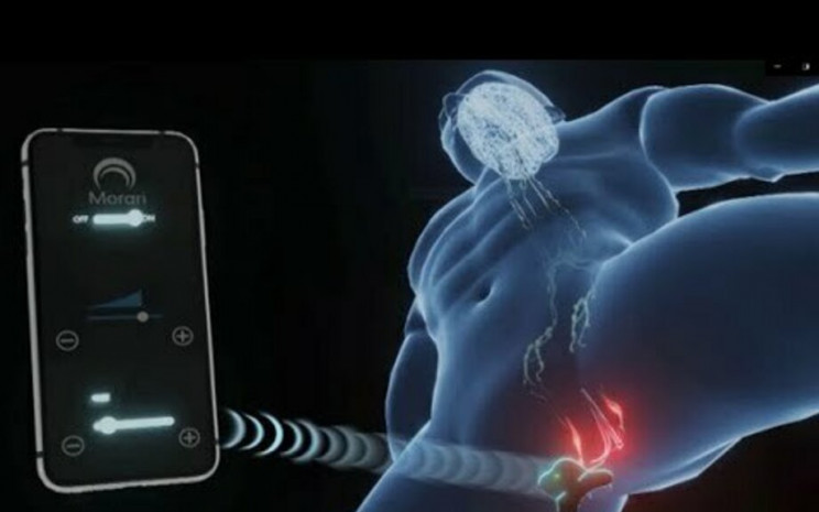 wierd tech ces delayed ejaculation