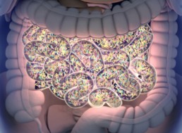 That Gut Feeling: How Depression and Constipation Are Linked