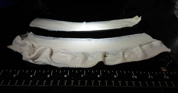 Lab-Grown Edible Muscles: Researchers Take a Huge Step Forward in Fake Food