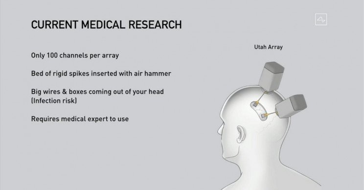 neuralink-present-medical-research Neuralink Present Medical Research