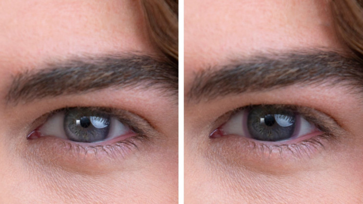 These Contact Lenses Turn Dark in Bright Sunlight