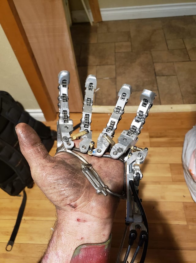 Not Satisfied With Digital Prosthetics, Man Invents Own Mechanical One Not Satisfied With Digital Prosthetics, Man Invents Own Mechanical One