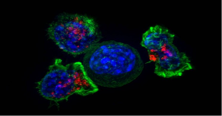 In 2030 There Will Be over 22 Million Cancer Survivors in the U.S.