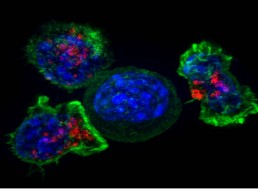 In 2030 There Will Be over 22 Million Cancer Survivors in the U.S.