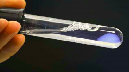 Scientists Just Bioprinted a Pancreas That Could End Diabetes